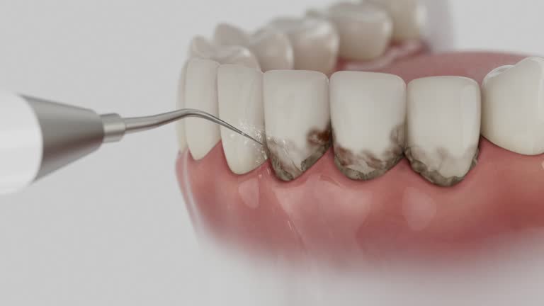 Trusted Dental Implants service in Gonzales, LA - Dentist Open Now